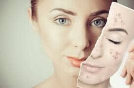 Substituindo o botox