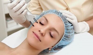 O que é rejuvenescimento fracionado da pele