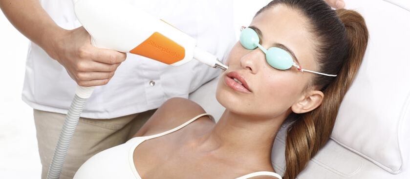 Resurfacing da pele a laser