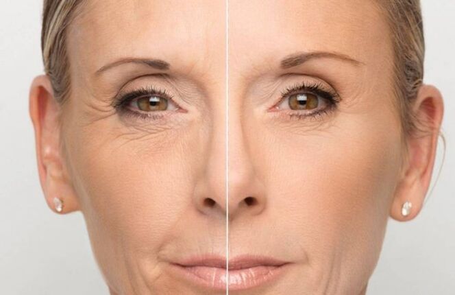 Pele facial antes e depois do rejuvenescimento com máscaras