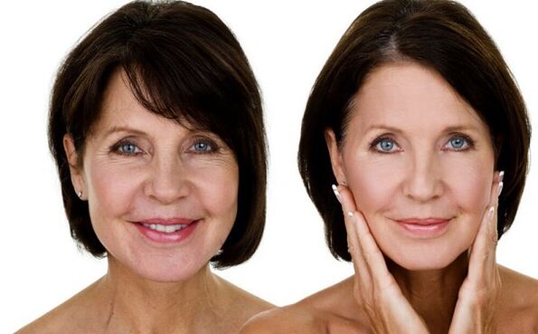 antes e depois do rejuvenescimento da pele facial em casa